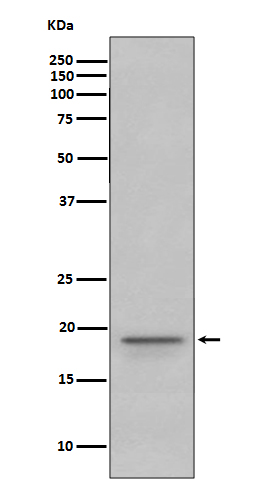 WB - Anti-Myelin Basic Protein MBP Rabbit Monoclonal Antibody ABO14277